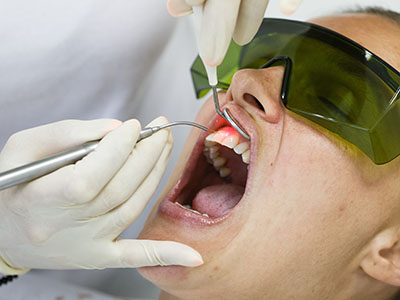 Parkside Family Dental | Ceramic Crowns, Dental Bridges and VELscope reg Cancer Screening